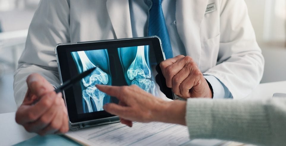 Osteoporoza – kako je prepoznati i koji faktori povećavaju rizik_68fdc83041ddd.jpeg