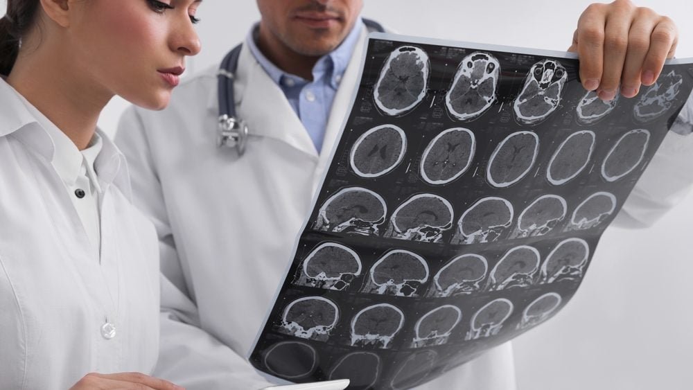 Rana upozorenja u krvi: Kako otkriti multiplu sklerozu pre nego što se pojave simptomi_69006b0407674.jpeg